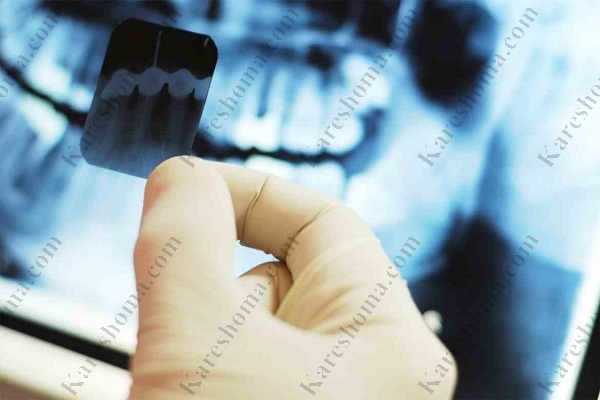 رادیولوژی دندان در اهواز