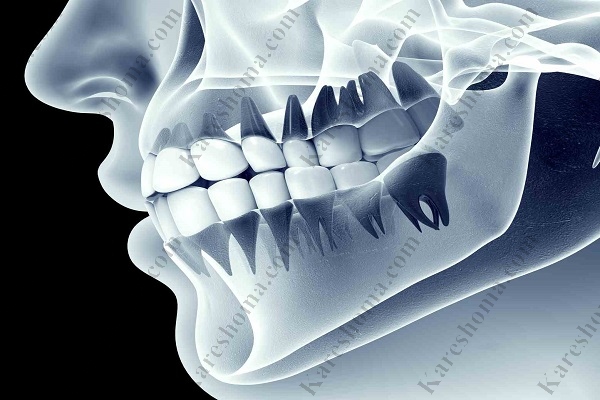 بهترین رادیولوژی دندان در اهواز