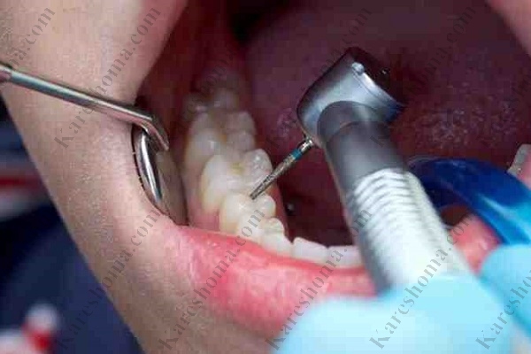 متخصص ریشه دندان اهواز