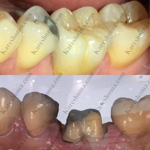 لابراتوار تخصصی دندانسازی کوشا اهواز 11
