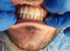 لابراتوار تخصصی دندانسازی کوشا اهواز 9