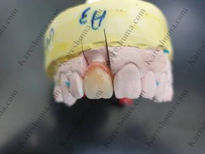 لابراتوار تخصصی دندانسازی کوشا اهواز 2