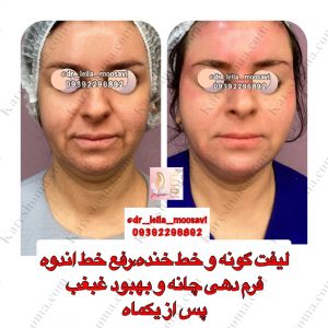 مطب زیبایی دکتر لیلا موسوی اهواز 1