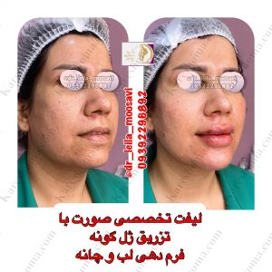 مطب زیبایی دکتر لیلا موسوی اهواز 10