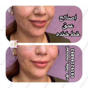 مطب زیبایی دکتر لیلا موسوی اهواز 11