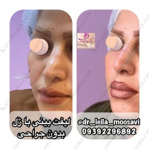 مطب زیبایی دکتر لیلا موسوی اهواز 12