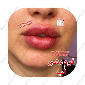 مطب زیبایی دکتر لیلا موسوی اهواز 13