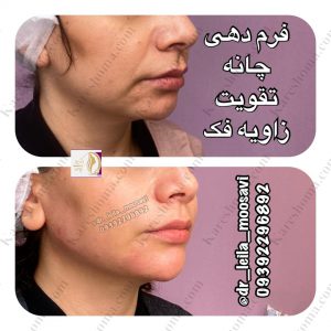 مطب زیبایی دکتر لیلا موسوی اهواز 14