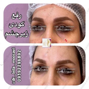 مطب زیبایی دکتر لیلا موسوی اهواز 15