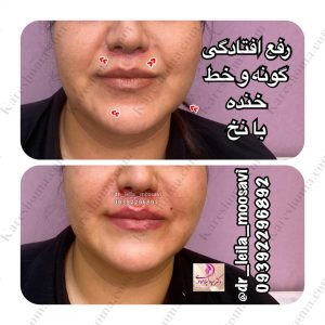 مطب زیبایی دکتر لیلا موسوی اهواز 3