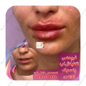مطب زیبایی دکتر لیلا موسوی اهواز 4