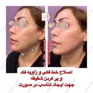 مطب زیبایی دکتر لیلا موسوی اهواز 8