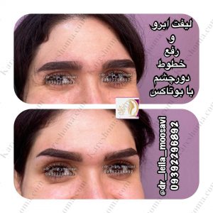 مطب زیبایی دکتر لیلا موسوی اهواز 9