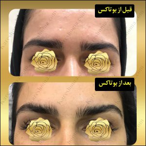 مطب زیبایی دکتر شهین ملک خیاط 2