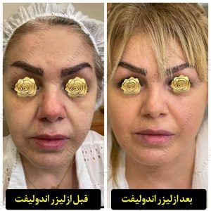 مطب زیبایی دکتر شهین ملک خیاط 7