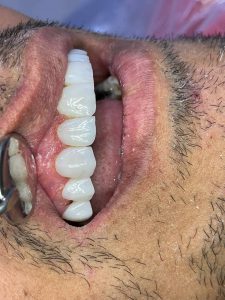 دکتر امین موسوی  – دندانپزشک ترمیمی و زیبایی اهواز 6