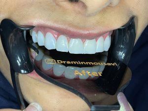 دکتر امین موسوی  – دندانپزشک ترمیمی و زیبایی اهواز 5