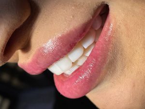 دکتر امین موسوی  – دندانپزشک ترمیمی و زیبایی اهواز 4