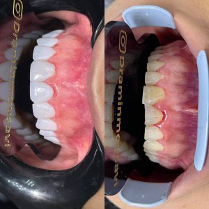 دکتر امین موسوی  – دندانپزشک ترمیمی و زیبایی اهواز 3