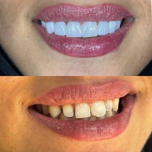 دکتر امین موسوی  – دندانپزشک ترمیمی و زیبایی اهواز 7
