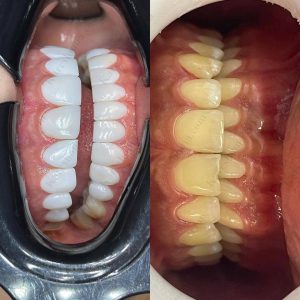 دکتر امین موسوی  – دندانپزشک ترمیمی و زیبایی اهواز 8