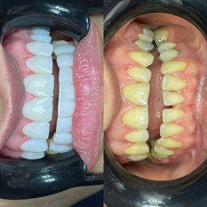 دکتر امین موسوی  – دندانپزشک ترمیمی و زیبایی اهواز 9