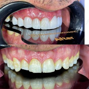 دکتر امین موسوی  – دندانپزشک ترمیمی و زیبایی اهواز 10