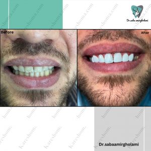 دکتر صبا امیرغلامی دندانپزشک اهواز 3